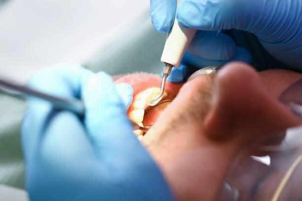Best Weekend Emergency Dentist in Woodstock, VA