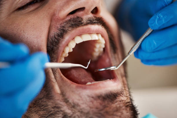 Best Broken or Cracked Tooth Emergency Dentist in Woodstock, VA