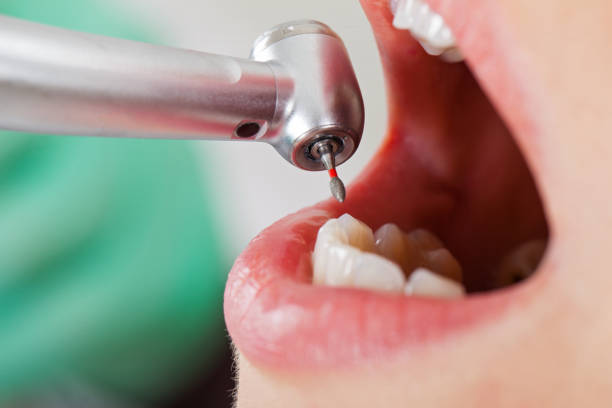 Best Emergency Dentist for Special Needs Patients in Woodstock, VA